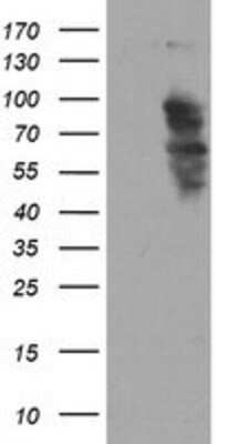 Western Blot: SOX5 Antibody (2A8) [NBP2-03766] HEK293T cells were transfected with the pCMV6-ENTRY control (Left lane) or pCMV6-ENTRY SOX5 (Right lane) cDNA for 48 hrs and lysed. Equivalent amounts of cell lysates (5 ug per lane) were separated by SDS-PAGE and immunoblotted with anti-SOX5.