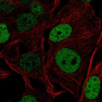 Immunocytochemistry/Immunofluorescence: SOX5 Antibody [NBP2-56571] - Staining of human cell line SK-MEL-30 shows localization to nucleoplasm.