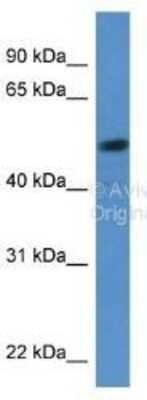 Western Blot: SOX5 Antibody [NBP1-74096] - Dilution: 1 ug/ml on Hela cell lysate.