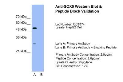 Western Blot: SOX5 Antibody [NBP1-74096] - Sample Tissue: HepG2, Lane A: Primary Antibody, Lane B: Primary Antibody + Blocking Peptide, Primary Antibody Concentration: 2.0ug/mL, Peptide Concentration: 2.0ug/mL, Lysate Quantity: 25ug/lane, Gel Concentration: 12%