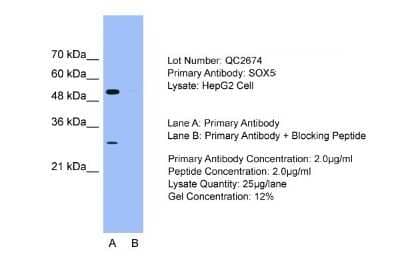 Western Blot SOX5 Antibody