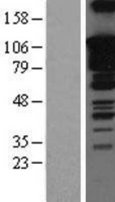 Western Blot SOX5 Overexpression Lysate