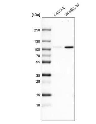 Western Blot: SOX6 Antibody (CL5685) [NBP2-61422] - Analysis in human cell line CACO-2 and human cell line SK-MEL-30