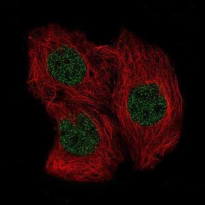 <b>Orthogonal Strategies Validation. </b>Immunocytochemistry/Immunofluorescence: SOX6 Antibody (CL5690) [NBP2-61423] - Staining of CACO-2 cells using the Anti-SOX6 monoclonal antibody, showing specific staining in the nucleoplasm in green. Microtubule- and nuclear probes are visualized in red and blue, respectively (where available). Antibody staining is shown in green.