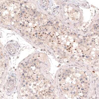 Immunohistochemistry-Paraffin: SOX6 Antibody (CL5690) [NBP2-61423] - Staining of human testis shows moderate nuclear immunoreactivity in a subset of cells in seminiferous tubules.