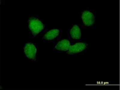 Immunocytochemistry/Immunofluorescence: SOX6 Antibody [H00055553-B01P] - Analysis of purified antibody to SOX6 on HeLa cell. (antibody concentration 10 ug/ml)