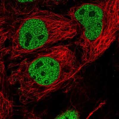 <b>Orthogonal Strategies Validation. </b>Immunocytochemistry/Immunofluorescence: SOX6 Antibody [NBP1-85811] - Staining of human cell line CACO-2 shows localization to nucleoplasm. Antibody staining is shown in green.