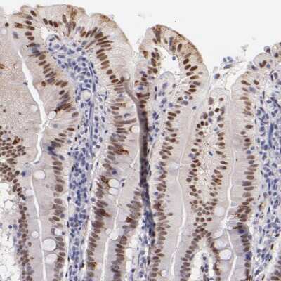 Immunohistochemistry-Paraffin: SOX6 Antibody [NBP1-85811] - Staining of human small intestine shows moderate nuclear positivity in glandular cells.