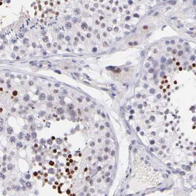 Immunohistochemistry-Paraffin: SOX6 Antibody [NBP1-85811] - Staining of human testis shows moderate to strong nuclear positivity in cells in seminiferous ducts, as well as weak positivity in Leydig cells.