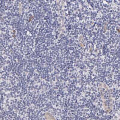 Immunohistochemistry-Paraffin: SOX6 Antibody [NBP1-85811] - Staining of human tonsil shows no positivity in lymphoid cells as expected.