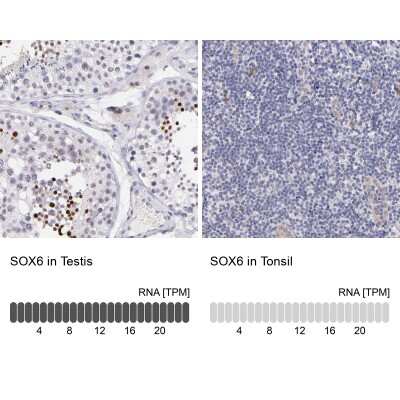 Immunohistochemistry-Paraffin: SOX6 Antibody [NBP1-85811] - Analysis in human testis and tonsil tissues using NBP1-85811 antibody. Corresponding SOX6 RNA-seq data are presented for the same tissues.