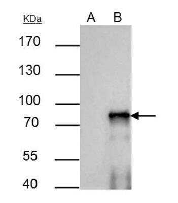 Immunoprecipitation: SOX6 Antibody [NBP2-20458] -  IP samples: HeLa whole cell extract A. Control with 5 ug of preimmune Rabbit IgG B. Immunoprecipitation of SOX6 protein by 5 ug SOX6 antibody [N1C3] 7.5 % SDS-PAGE. The immunoprecipitated SOX6 protein was detected by SOX6 antibody [N1C3] diluted at 1:500. [EasyBlot anti-rabbit IgG was used as a secondary reagent]