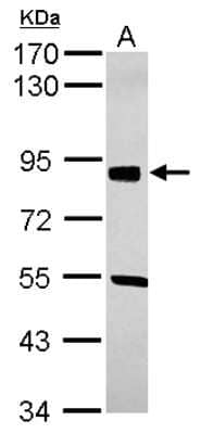 Western Blot: SOX6 Antibody [NBP2-20458] - Sample (30 ug of whole cell lysate) A: U87-MG 7. 5% SDS PAGE gel, diluted at 1:1000.