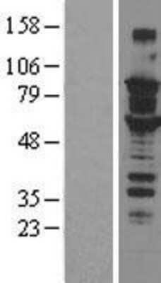 Western Blot: SOX6 Overexpression Lysate (Adult Normal) [NBL1-16354] Left-Empty vector transfected control cell lysate (HEK293 cell lysate); Right -Over-expression Lysate for SOX6.