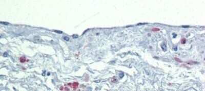 Immunohistochemistry-Paraffin: SOX7 Antibody [NBP1-80373] - Human Heart Tissue, antibody concentration 5.0ug/ml.