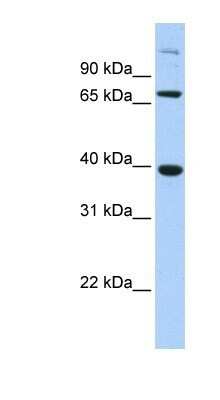 Western Blot: SOX7 Antibody [NBP1-80373] - Transfected 293T, Antibody Titration: 0.2-1 ug/ml