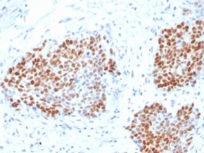 Immunohistochemistry-Paraffin: SOX9 Antibody (SOX9/3916R) - Azide and BSA Free [NBP3-08400] - Formalin-fixed, paraffin-embedded human Pancreas stained with SOX9 Recombinant Rabbit Monoclonal Antibody (SOX9/3916R).