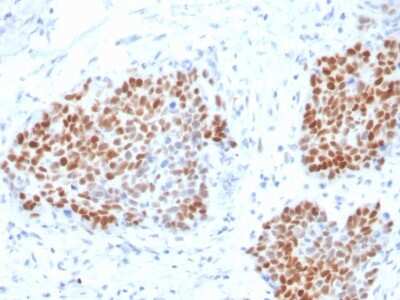 Immunohistochemistry-Paraffin: SOX9 Antibody (SOX9/3916R) [NBP3-07660] - Formalin-fixed, paraffin-embedded human Pancreas stained with SOX9 Recombinant Rabbit Monoclonal Antibody (SOX9/3916R).