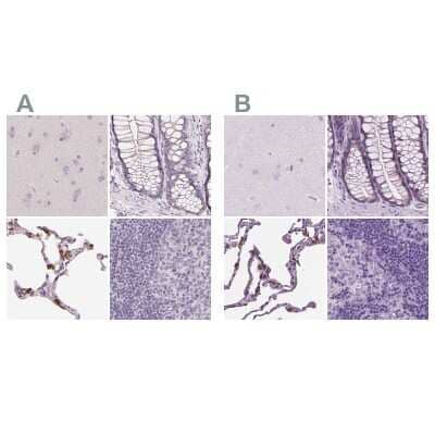 <b>Independent Antibodies Validation. </b>Immunohistochemistry-Paraffin: SP-D Antibody [NBP2-33424] - Staining of human cerebral cortex, colon, lung and lymph node using Anti-SFTPD antibody NBP2-33424 (A) shows similar protein distribution across tissues to independent antibody NBP2-38803 (B).