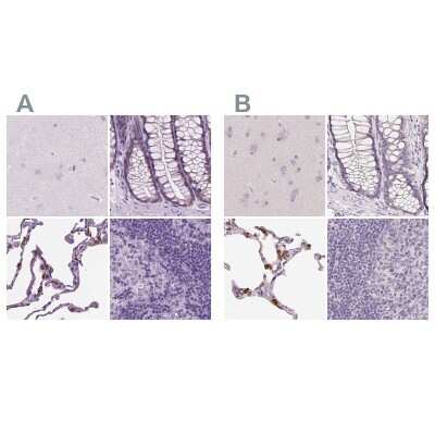 <b>Independent Antibodies Validation and Orthogonal Strategies Validation.</b>Immunohistochemistry-Paraffin: SP-D Antibody [NBP2-38803] - Staining of human cerebral cortex, colon, lung and lymph node using Anti-SFTPD antibody NBP2-38803 (A) shows similar protein distribution across tissues to independent antibody NBP2-33424 (B).