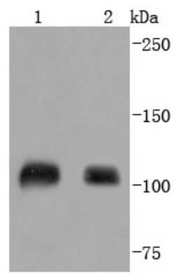 Western Blot: SP1 Antibody (JF0950) [NBP2-67159] - Analysis of SP1 on different lysates using anti-SP1 antibody at 1/1,000 dilution. Positive control: Lane 1: Jurkat Lane 2: Hela
