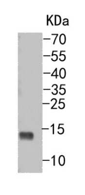 Western Blot: SP1 Antibody (JF0950) [NBP2-67159] - Western blot analysis of SP1 on U937 cells using anti-SP1 antibody at 1/500 dilution.