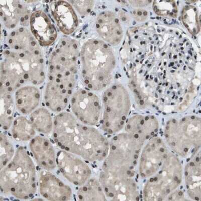 Immunohistochemistry-Paraffin: SP100 Antibody [NBP1-89457] - Staining of human kidney shows moderate nuclear positivity in cells in tubules.