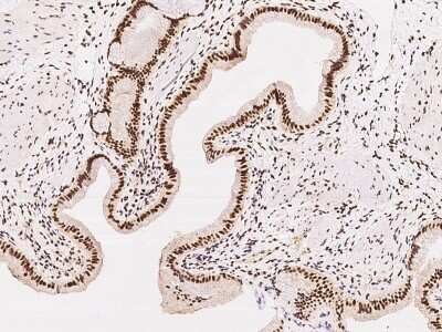 Immunohistochemistry-Paraffin: SP100 Antibody [NBP2-97407] - Immunochemical staining of human SP100 in human gallbladder with rabbit polyclonal antibody at 1:1000 dilution, formalin-fixed paraffin embedded sections.