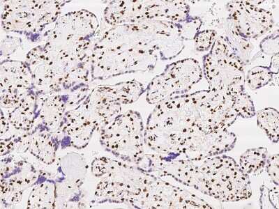 Immunohistochemistry-Paraffin: SP100 Antibody [NBP2-97408] - Immunochemical staining of human SP100 in human placenta with rabbit polyclonal antibody at 1:500 dilution, formalin-fixed paraffin embedded sections.