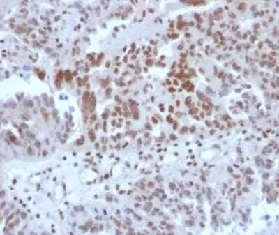 Immunohistochemistry-Paraffin: SP100 Antibody (PCRP-SP100-1B9) [NBP3-13780] - IHC analysis of formalin-fixed, paraffin-embedded human colon. Strong nuclear staining using SP100 antibody (PCRP-SP100-1B9) at 2ug/ml in PBS for 30min RT. HIER: Tris/EDTA, pH9.0, 45min. HRP-polymer, 30min. DAB, 5min.