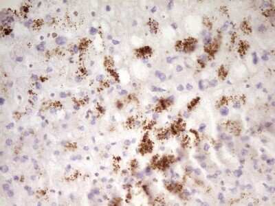 Immunohistochemistry: SP110 Antibody (4C1) [NBP2-45919] - Analysis of Human liver tissue. (Heat-induced epitope retrieval by 1 mM EDTA in 10mM Tris, pH8.5, 120C for 3min)