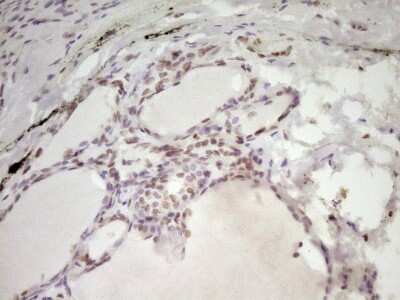 Immunohistochemistry: SP110 Antibody (4C1) [NBP2-45919] - Analysis of Human thyroid tissue. (Heat-induced epitope retrieval by 1 mM EDTA in 10mM Tris, pH8.5, 120C for 3min)