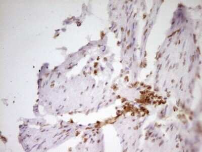 Immunohistochemistry: SP110 Antibody (4C1) [NBP2-45919] - Analysis of Human bladder tissue. (Heat-induced epitope retrieval by 1 mM EDTA in 10mM Tris, pH8.5, 120C for 3min)