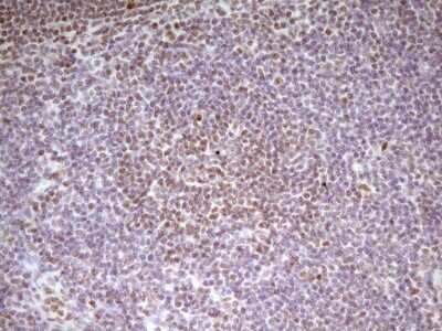 Immunohistochemistry: SP110 Antibody (4C1) [NBP2-45919] - Analysis of Human lymph node tissue. (Heat-induced epitope retrieval by 1 mM EDTA in 10mM Tris, pH8.5, 120C for 3min)