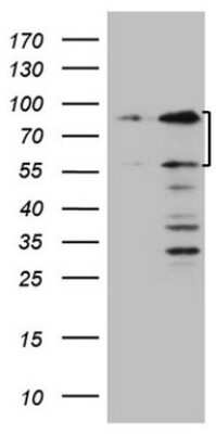 Western Blot: SP110 Antibody (4C1) [NBP2-45919] - Analysis of HEK293T cells were transfected with the pCMV6-ENTRY control (Left lane) or pCMV6-ENTRY SP110.