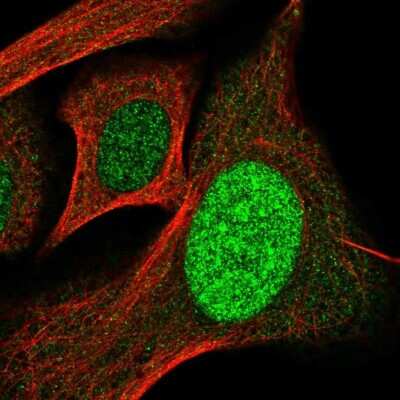 Immunocytochemistry/Immunofluorescence: SP110 Antibody [NBP2-56189] - Staining of human cell line U-2 OS shows localization to nucleus.