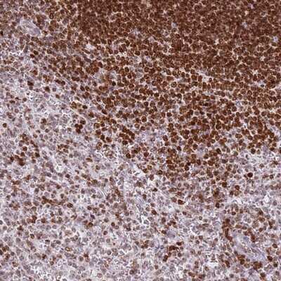 Immunohistochemistry-Paraffin: SP110 Antibody [NBP1-92426] - Staining of human spleen shows strong nuclear positivity in cells in white pulp.