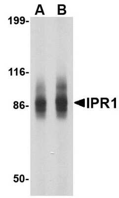 Western Blot: SP110 Antibody [NBP1-76385] - SW480 cell lysate with IPR1 antibody at (A) 1 and (B) 2 ug/ml.