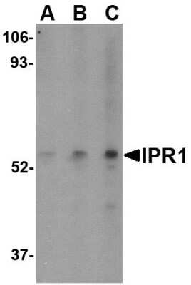 Western Blot: SP110 Antibody [NBP1-77316] - Hela cell lysate with SP110 antibody at (A) 0.5, (B) 1, and (C) 2 ug/ml.