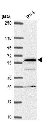 Western Blot: SP110 Antibody [NBP2-56189] - Western blot analysis in human cell line RT-4.