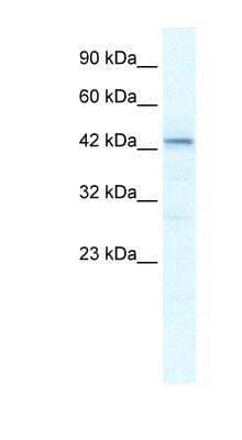 Western Blot: SP140L Antibody [NBP1-80140] - Jurkat cell lysate, concentration 2.5 ug/ml.