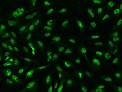 Immunocytochemistry/Immunofluorescence: SP4 Antibody [NBP2-97665] - Immunofluorescence staining of SP4 in U251MG cells. Cells were fixed with 4% PFA, permeabilzed with 0.1% Triton X-100 in PBS, blocked with 10% serum, and incubated with rabbit anti-Human SP4 polyclonal antibody (dilution ratio 1:200) at 4C overnight. Then cells were stained with the Alexa Fluor(R)488-conjugated Goat Anti-rabbit IgG secondary antibody (green). Positive staining was localized to Nucleus.