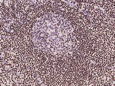 Immunohistochemistry-Paraffin: SP4 Antibody [NBP2-97665] - Immunochemical staining of human SP4 in human lymph node with rabbit polyclonal antibody at 1:300 dilution, formalin-fixed paraffin embedded sections.