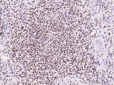 Immunohistochemistry-Paraffin: SP4 Antibody [NBP2-97665] - Immunochemical staining of human SP4 in human spleen with rabbit polyclonal antibody at 1:300 dilution, formalin-fixed paraffin embedded sections.