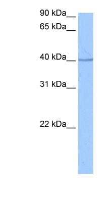 Western Blot SP6 Antibody