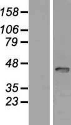 Western Blot SP6 Overexpression Lysate