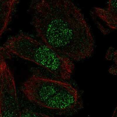 Immunocytochemistry/Immunofluorescence: SP8 Antibody [NBP2-49109] - Staining of human cell line PC-3 shows localization to nucleus. Antibody staining is shown in green.