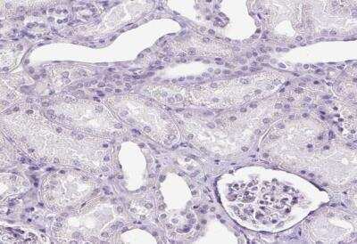 Immunohistochemistry-Paraffin: SP8 Antibody [NBP2-49109] - Staining of human kidney shows no positivity in cells in tubules as expected.