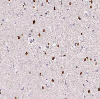 Immunohistochemistry-Paraffin SP9 Antibody