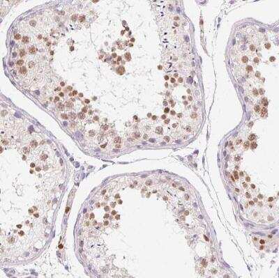 Immunohistochemistry-Paraffin SP9 Antibody